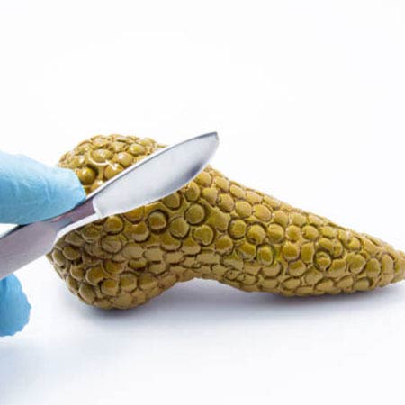 hepatobiliary pancreatic surgery Chennai
